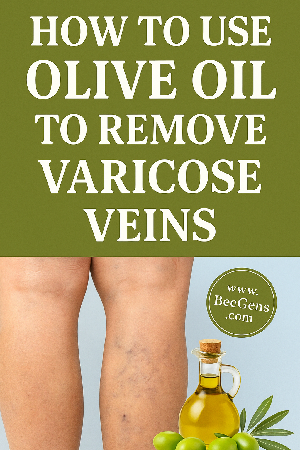Natural Remedies for Varicose Veins